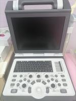 Портативный УЗИ аппарат SIUI 1100