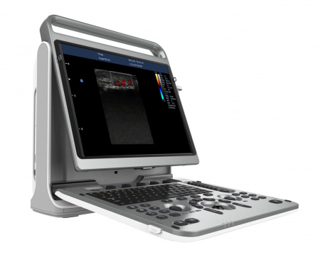 Chison SonoTouch 60